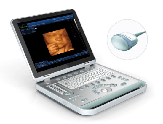 3D Laptop Color Doppler Portable Ultrasound with High Quality gallery image 5