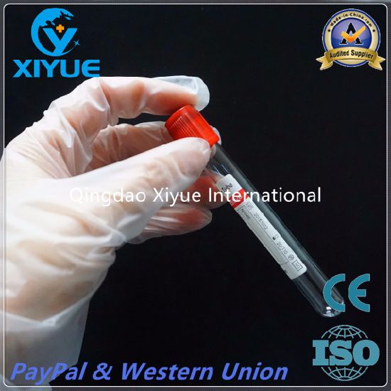 Ce & ISO Disposable Vacuum Blood Collection Clot Activator Tube with High Quality gallery image 2