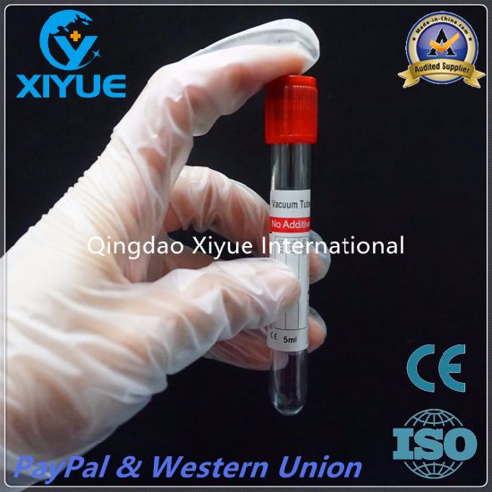 Ce & ISO Disposable Vacuum Blood Collection Clot Activator Tube with High Quality gallery image 3