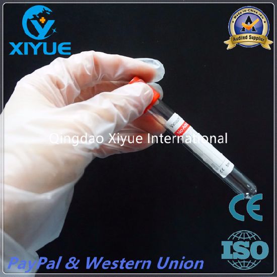 Ce & ISO Disposable Vacuum Blood Collection Clot Activator Tube with High Quality gallery image 4