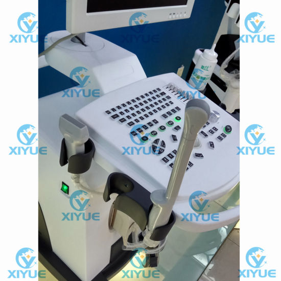 Cy-370 W2.0 Version Full-Digital Laptop Ultrasound Scanner gallery image 2
