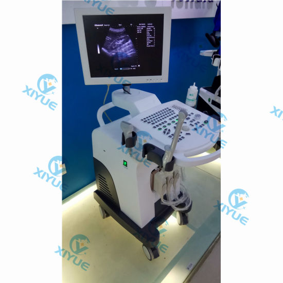 Cy-370 W2.0 Version Full-Digital Laptop Ultrasound Scanner gallery image 3