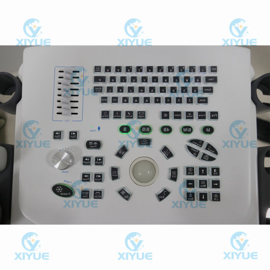 Cy-370 W2.0 Version Full-Digital Laptop Ultrasound Scanner gallery image 4