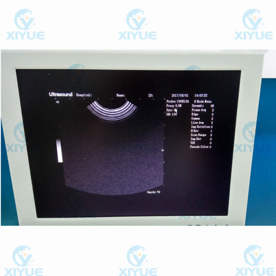 Cy-370 W2.0 Version Full-Digital Laptop Ultrasound Scanner gallery image 5
