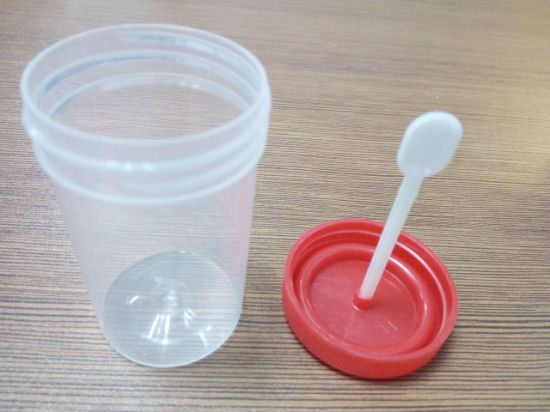 Disposable PP Hospital Consumables Sterile Urine Container gallery image 3