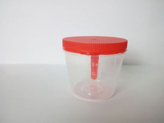 Disposable Sterile Urine Container gallery image 1