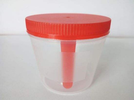 Disposable Sterile Urine Container gallery image 2