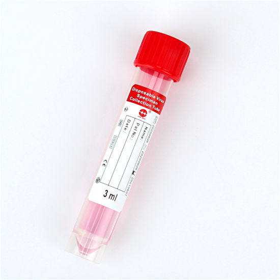 Disposable Virus Specimen Collection Tube gallery image 4