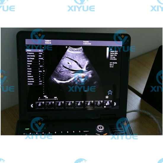 Dw-C60 Popular 3D Color Doppler Ultrasound System gallery image 3