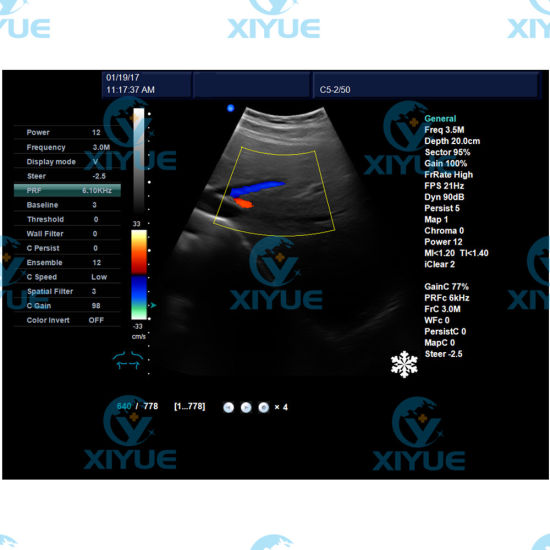 Dw-C60 Popular 3D Color Doppler Ultrasound System gallery image 4