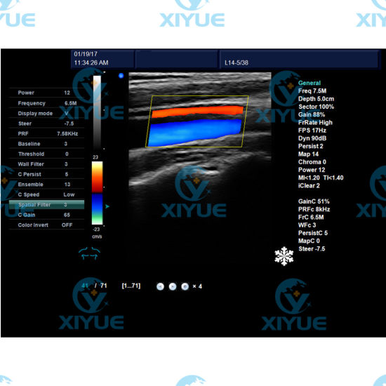 Dw-C60 Popular 3D Color Doppler Ultrasound System gallery image 5