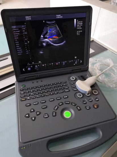 Dw-C60 Popular Laptop 4D Color Doppler Ultrasound Scanner Ultrasonic Device gallery image 1