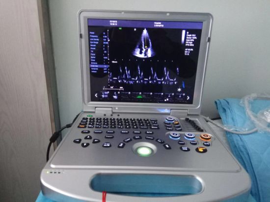 Dw-C60 Popular Laptop 4D Color Doppler Ultrasound Scanner Ultrasonic Device gallery image 2