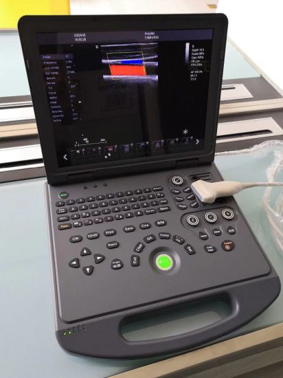 Dw-C60 Popular Laptop 4D Color Doppler Ultrasound Scanner Ultrasonic Device gallery image 3