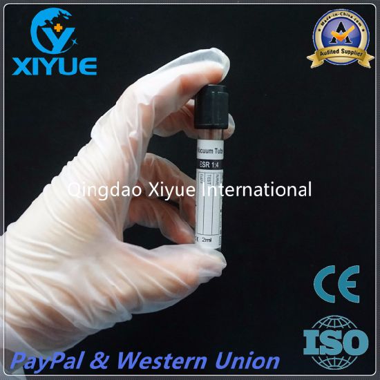 ESR Disposable Vacuum Blood Collection Tube with High Quality gallery image 1