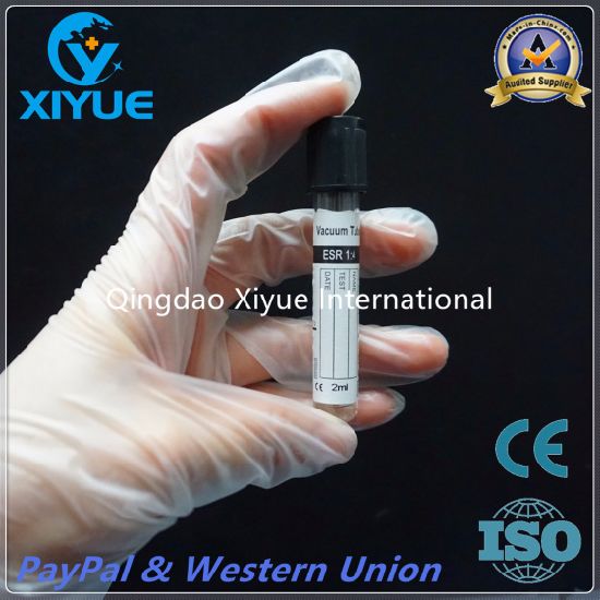 ESR Disposable Vacuum Blood Collection Tube with High Quality gallery image 4