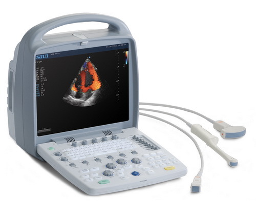 Full Digital Ultrasound Scanner with High Quality gallery image 1