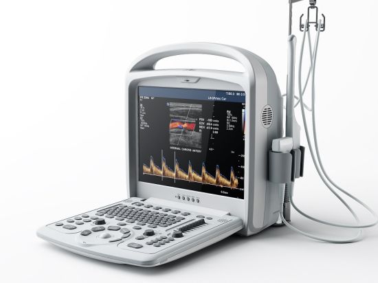 Full Digital Ultrasound Scanner with High Quality gallery image 2