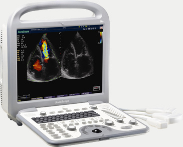 Full Digital Ultrasound Scanner with High Quality gallery image 4