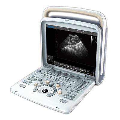 Full Digital Ultrasound Scanner with High Quality gallery image 5