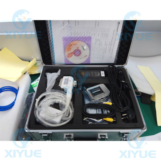 Laptop Full Digital Ultrasonic Diagnostic System Cy-580 gallery image 1
