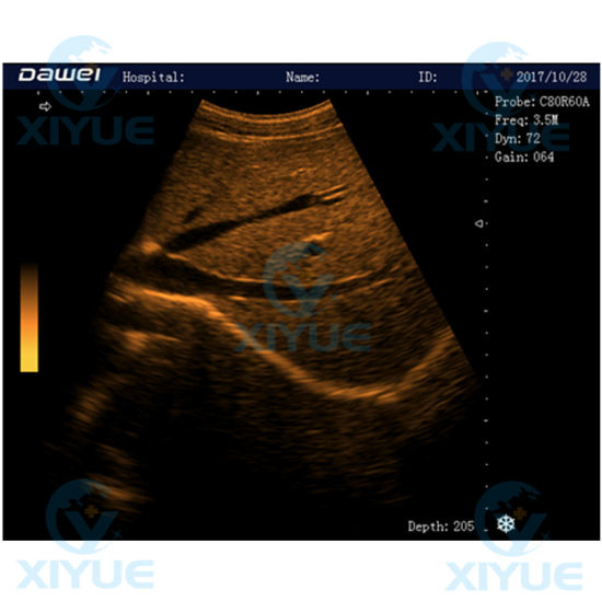 Laptop Full Digital Ultrasonic Diagnostic System Cy-580 gallery image 2