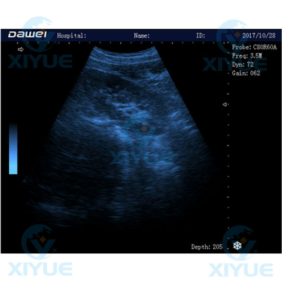 Laptop Full Digital Ultrasonic Diagnostic System Cy-580 gallery image 3