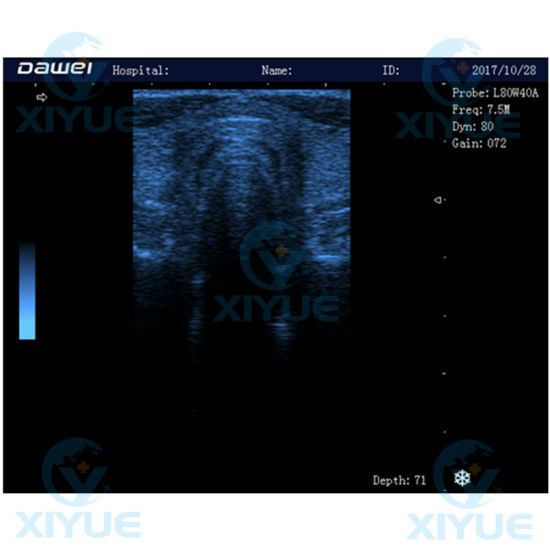 Laptop Full Digital Ultrasonic Diagnostic System Cy-580 gallery image 4