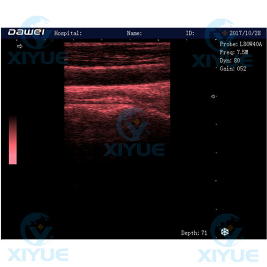 Laptop Full Digital Ultrasonic Diagnostic System Cy-580 gallery image 5