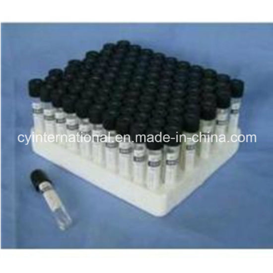 Medical Disposable Blood Collection ESR Tube gallery image 4