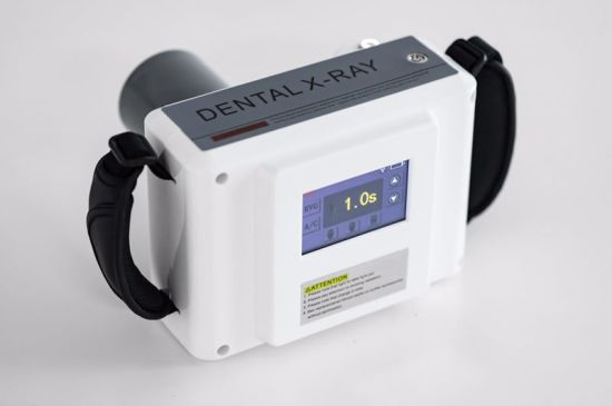 Medical Portable Oral X Ray Sensor Digital Machine with High-Definition gallery image 3