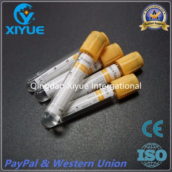 Medical Vacuum Blood Collection Tube with High Quality gallery image 1