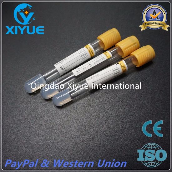 Medical Vacuum Blood Collection Tube with High Quality gallery image 2