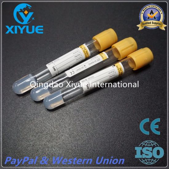 Medical Vacuum Blood Collection Tube with High Quality gallery image 3