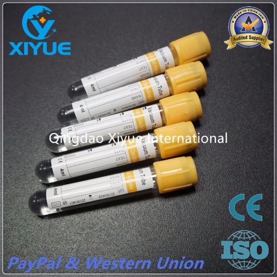 Medical Vacuum Blood Collection Tube with High Quality gallery image 4