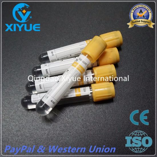 Medical Vacuum Blood Collection Tube with High Quality gallery image 5