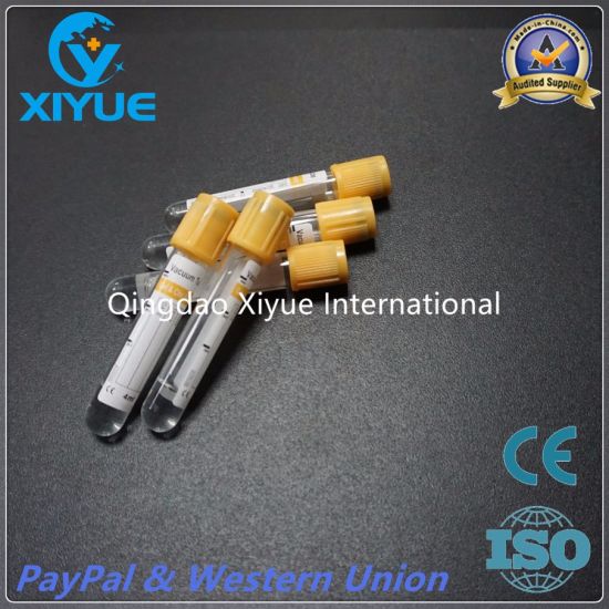 Medical Vacuum Blood Collection Tube with High Quality
