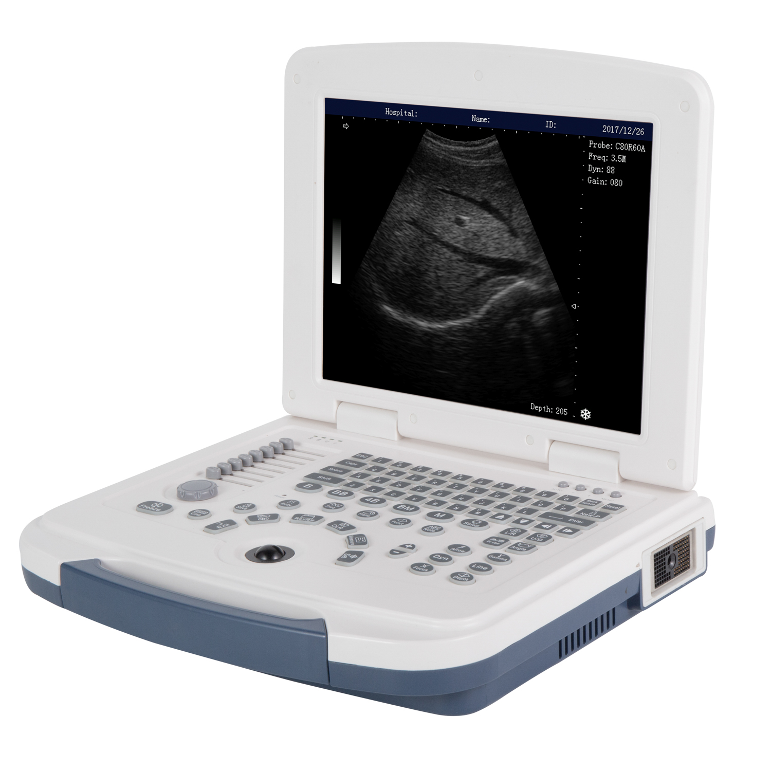 Portable 4D Color Ultrasound for Medical Diagnostic Imaging Center CY-L3