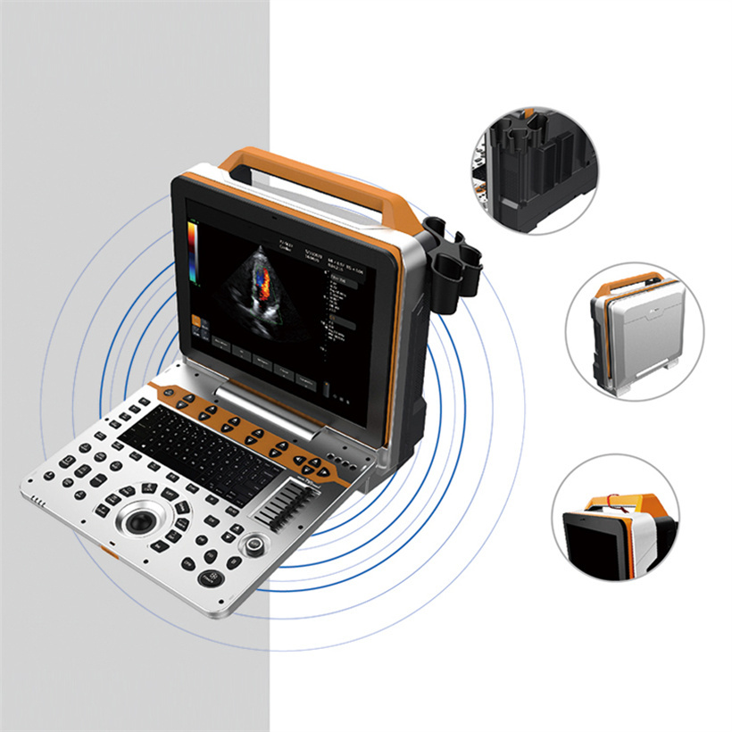 Portable 4D Color Ultrasound for Medical Diagnostic Imaging Center CY-P6