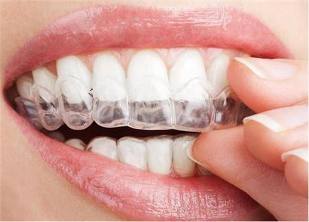 Silicone Soft Hard Retainer Teeth Straightening Corrector Dental Orthodontic Trainer gallery image 3