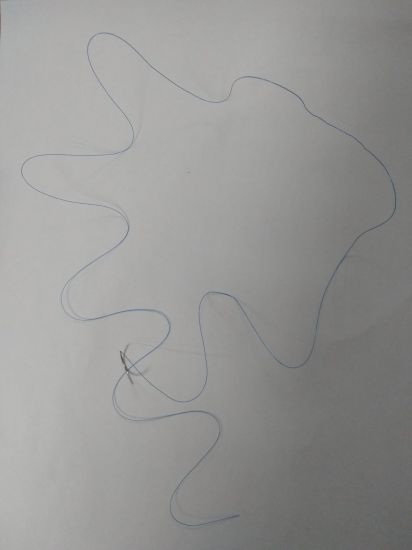 Surgical Suture Polypropylene Mono gallery image 2