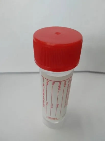 Universal 30ml Specimen Containers with Boric Acid gallery image 2