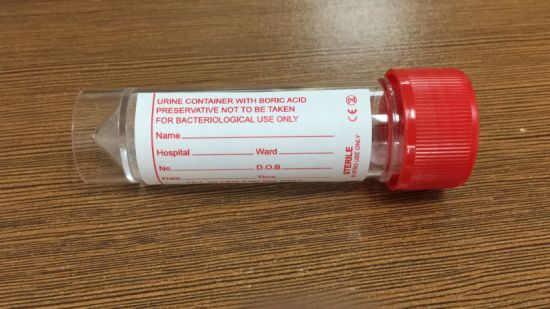 Universal Thirty Milliliter PS Specimen Containers with Boric Acid gallery image 1