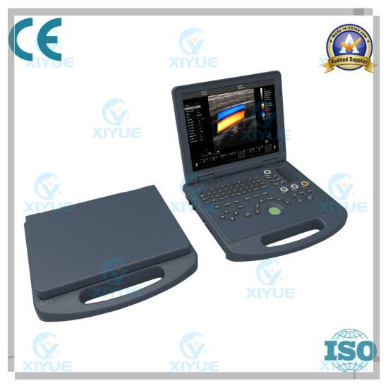 Dw-C60 Popular 3D Color Doppler Ultrasound System
