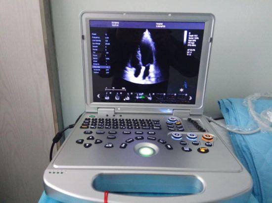 Dw-C60 Popular Laptop 4D Color Doppler Ultrasound Scanner Ultrasonic Device