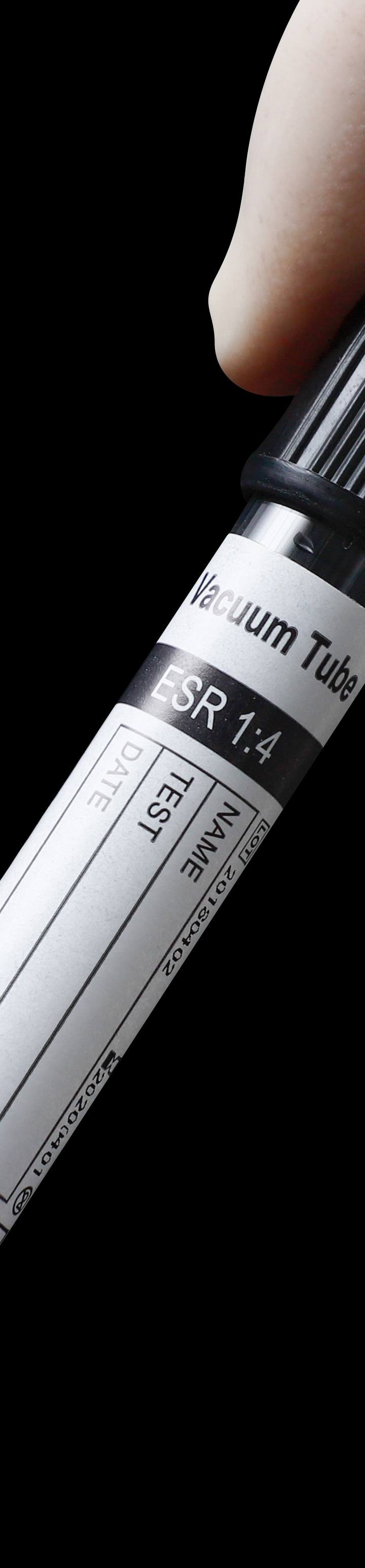 ESR Tube Sodium Citrate 1: 4 Vacuum Blood Collection Tube