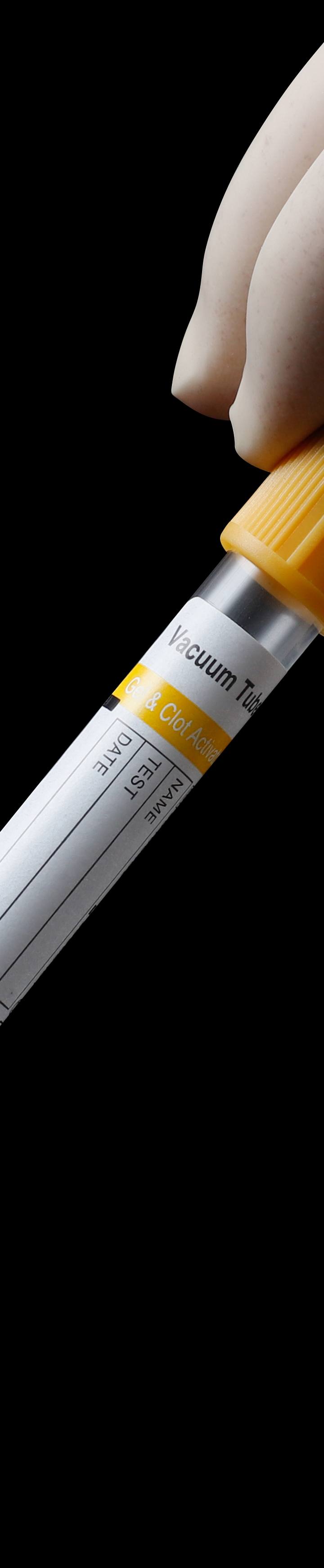 Gel+Clot Activator Vacuum Blood Collection Tube Yellow Cap