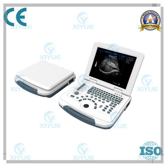 Laptop Full Digital Ultrasonic Diagnostic System Cy-580
