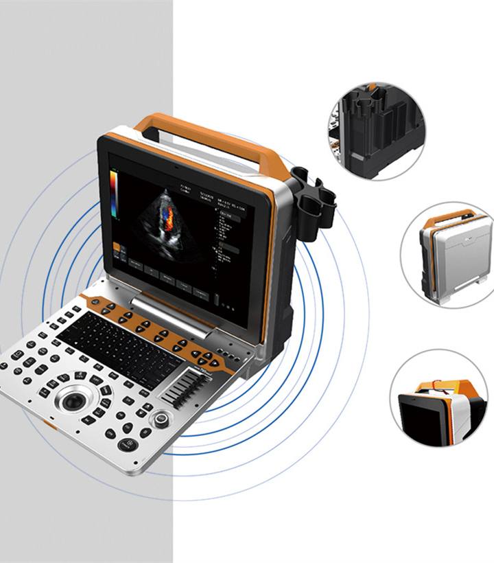 Portable 4D Color Ultrasound for Medical Diagnostic Imaging Center CY-P6