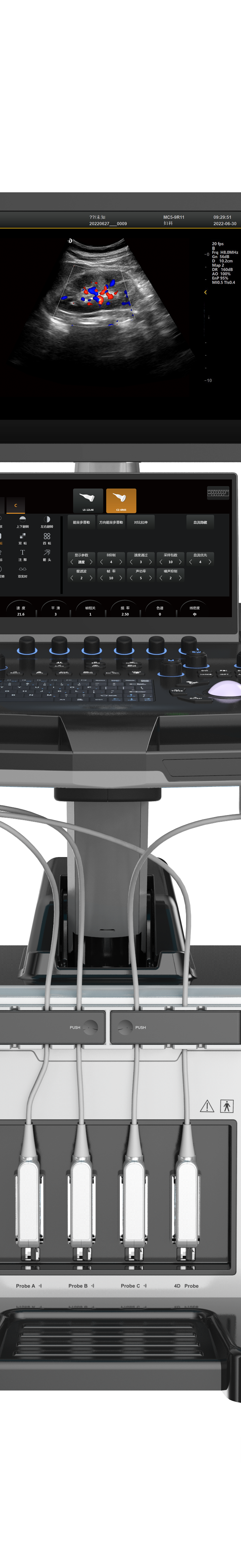 Portable 4D Color Ultrasound for Medical Diagnostic Imaging Center CY-T8